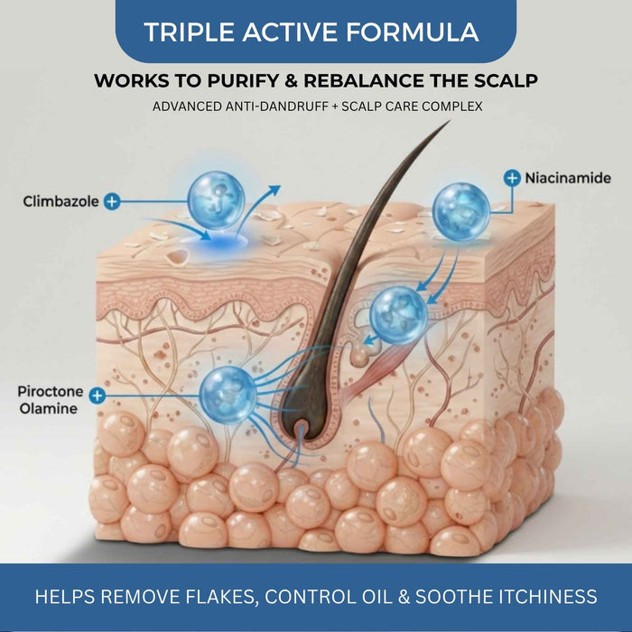Dandruff - 3 steps - Shampoo+Exfoliating Scalp Serum+Hair Mask - The Skin Story -