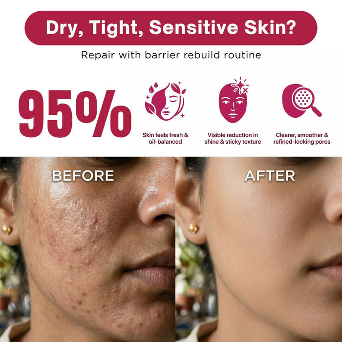 Oil Control Protect Regime – Shine Control & SPF Defense