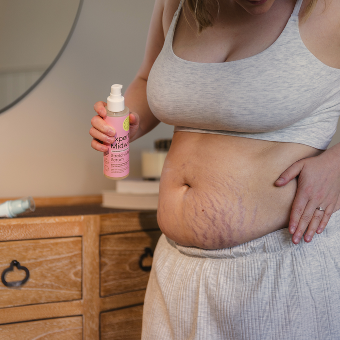 Person holding a bottle of Expert Midwife Stretch Mark Serum product with visible stretch marks on their stomach.